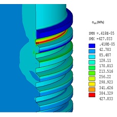 simulation numérique calculs mécaniques du comportement des matériaux